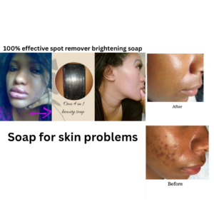 Soap for all skin problems
